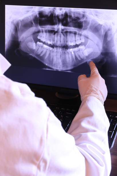 Best Emergency Wisdom Teeth Removal in Camden, AL